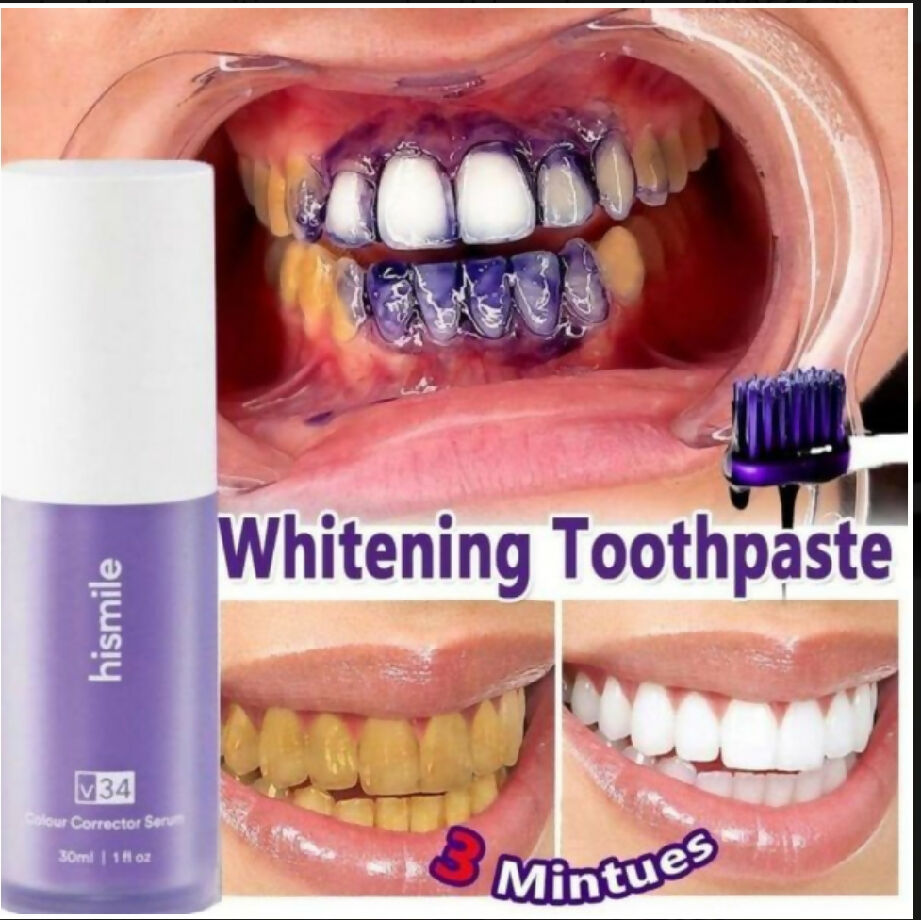 Teeth whitening