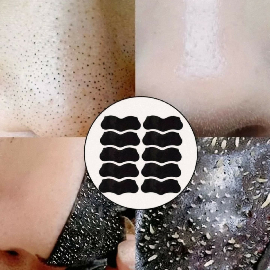 Kinyea nose blackheads whitehead removal shrink pores patch mask